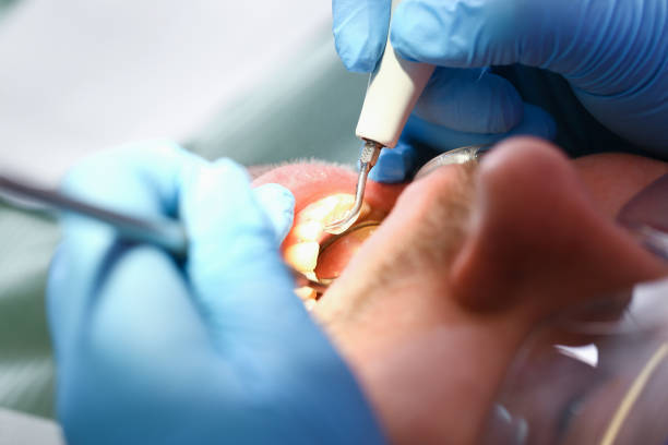 Best Walk-In Emergency Dentist in Nellieburg, MS
