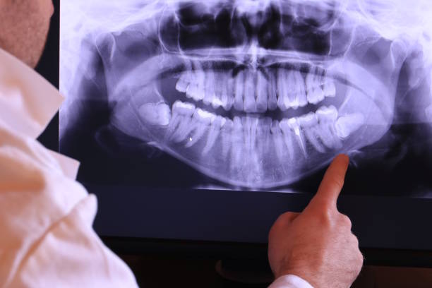 Best Urgent Dental Care in Nellieburg, MS
