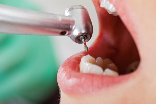 Best Emergency Broken Tooth Repair in Nellieburg, MS